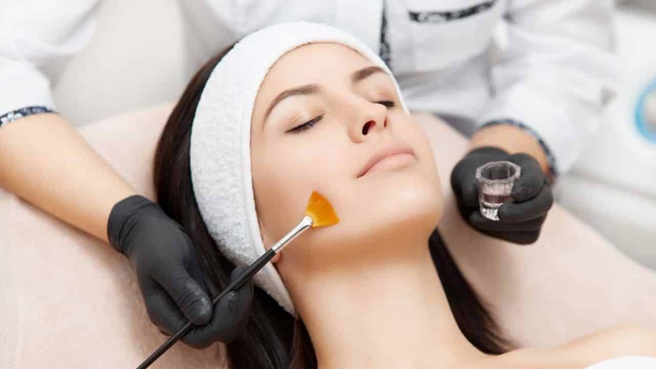 Peeling de fenol o que é Indicações recuperação e cuidados