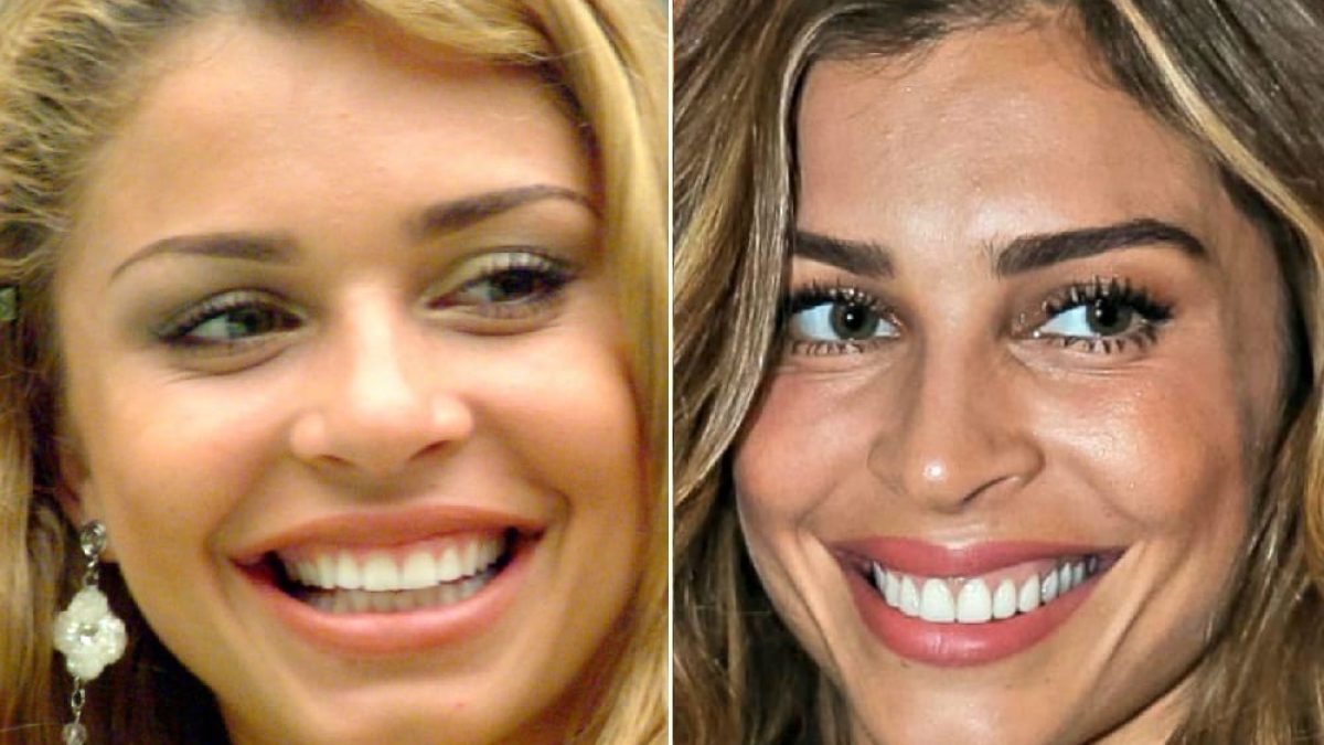 10 antes e depois do sorriso das famosas