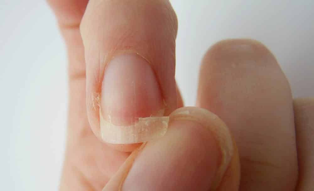 Como fortalecer as unhas enfraquecidas e impedir que elas quebrem
