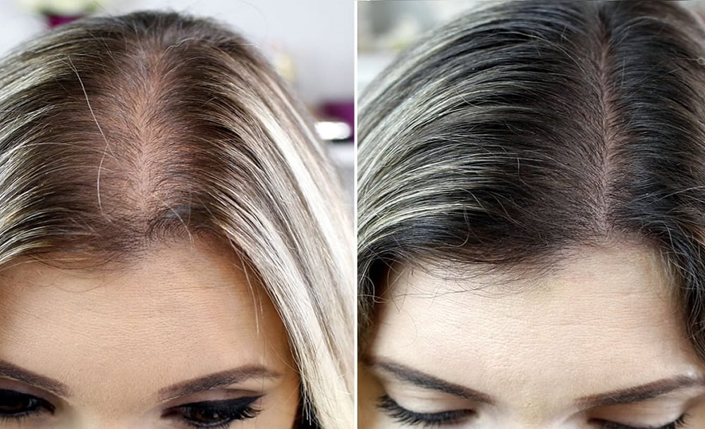 O que devo fazer quando o cabelo está caindo muito? O que pode ser? Como  acabar c/ a queda capilar? 