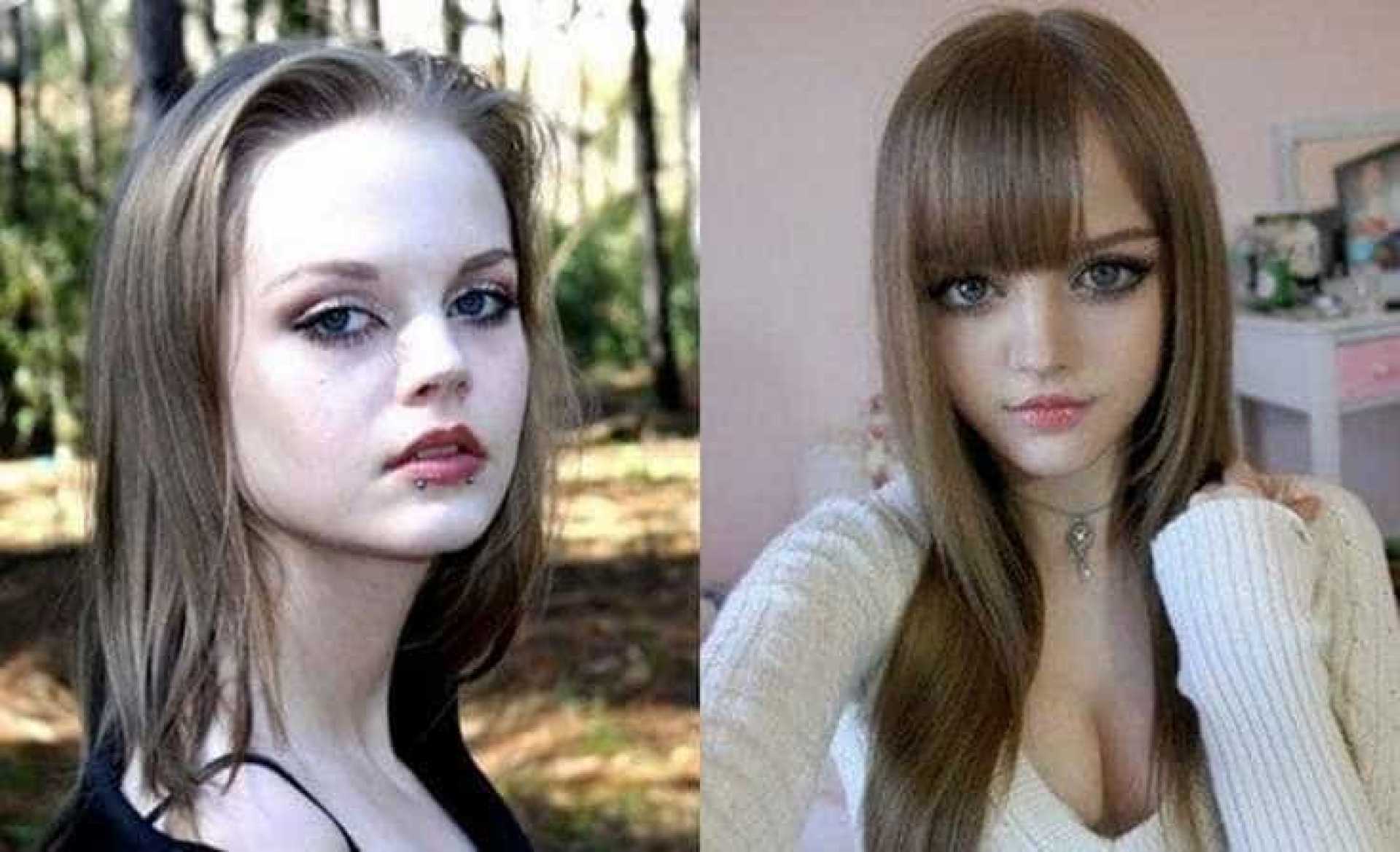Barbie Humana Antes E Depois