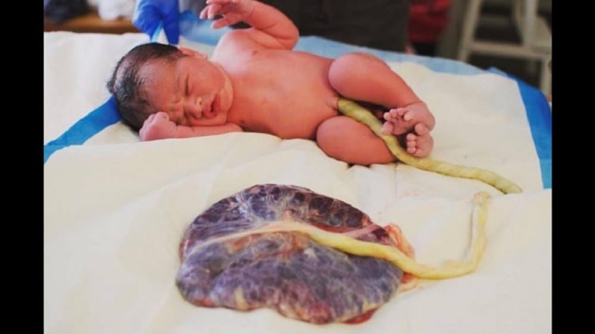 O que as pessoas fazem com a placenta depois do parto?