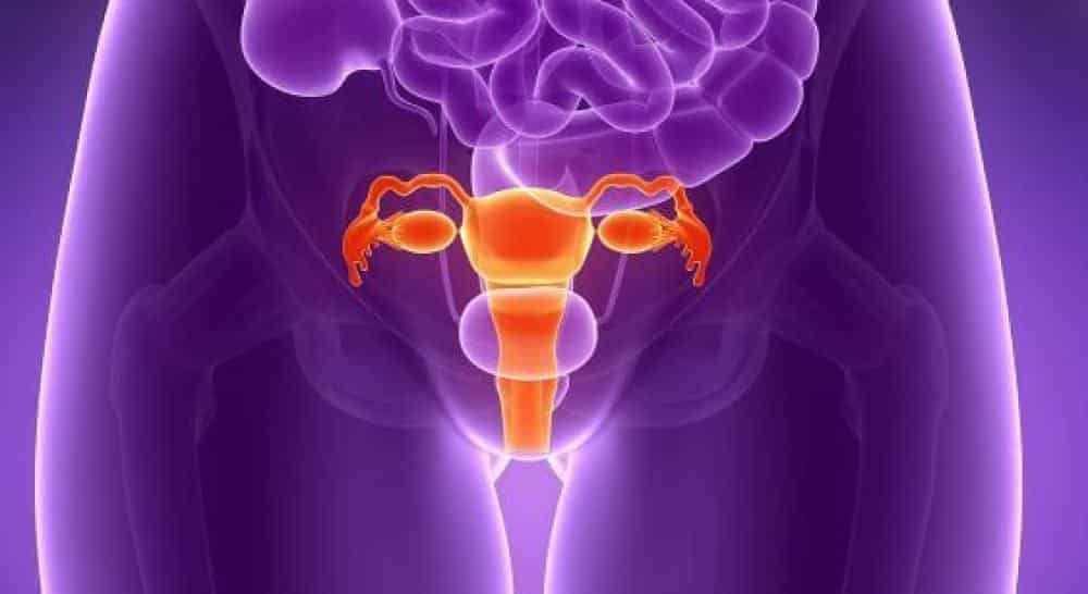 Endometriose, o que ? Sintomas, tratamento e preveno