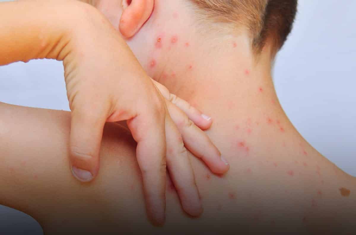 Confira agora as 10 doenças que podem causar mancha vermelha na pele
