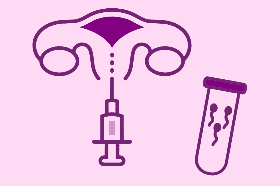 Inseminação artificial – Como funciona e quais os cuidados necessários