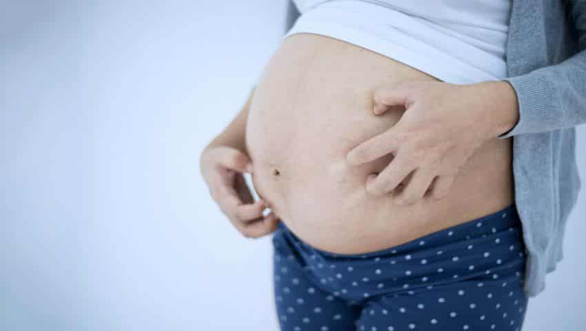 Alergias na gravidez – Possíveis causas e tratamentos