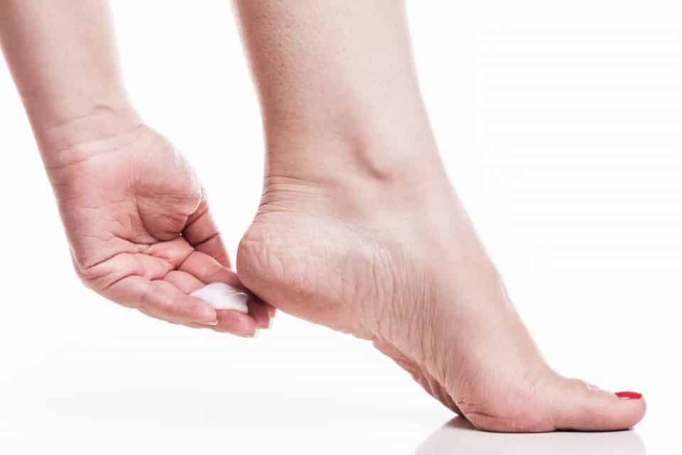 Remédio caseiro para rachadura nos pés, como fazer?