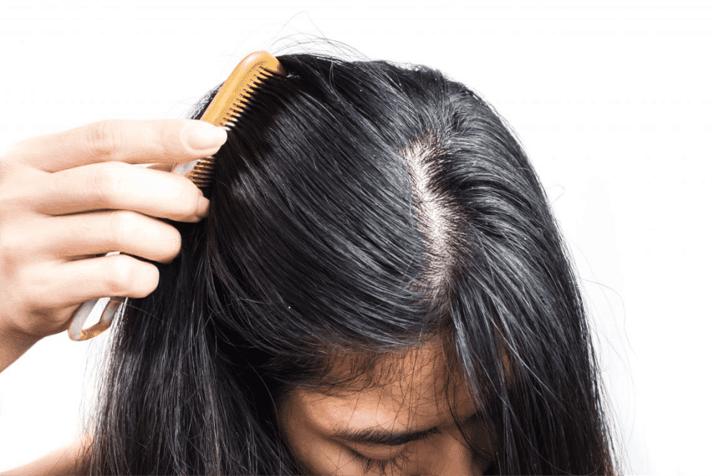 Ácido fólico para o cabelo