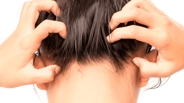 Espinha no couro cabeludo: qual a causa + como tratar